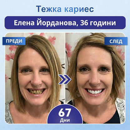 🇧🇬🦷 Кажете сбогом на чувствителността и дискомфорта! 𝐂𝐨𝐚𝐮𝐨𝐨® Tideglusib орални ленти – бързо възстановяване за зъби и венци 😊
